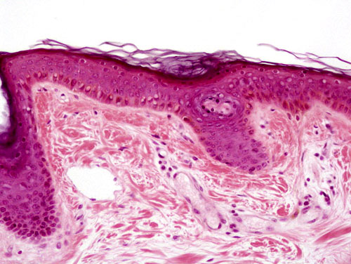 connective tissue slide