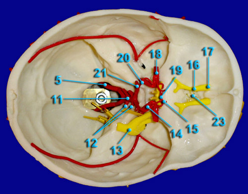 CEREBRAL VASULATURE CIRCLE OF WILIS SUPERIOR VIEW