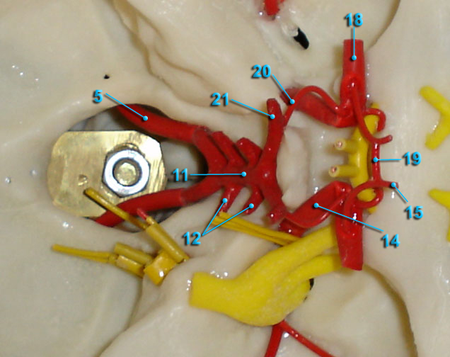 Circle of Willis - Large Image