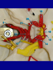 Circle of Willis Enlarged