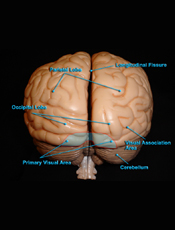 Brain - Posterior View