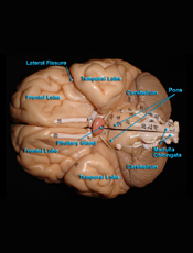 Brain - Inferior View