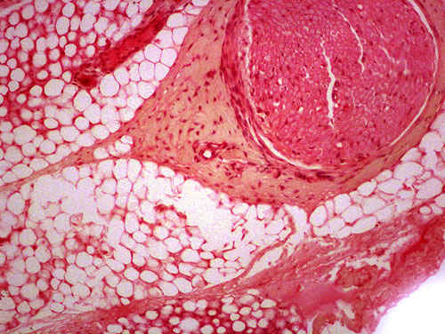 connective tissue slide