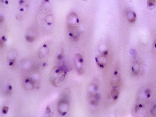 hyaline cartilage