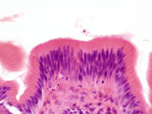 epithelial tissue