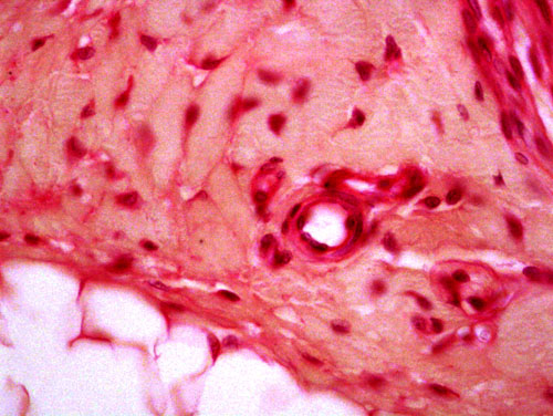 endothelium slide