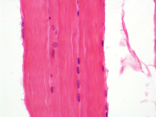 skeletal muscle slide